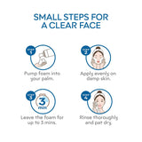 Sebamed Clear Face Cleansing Foam for Acne prone Skin